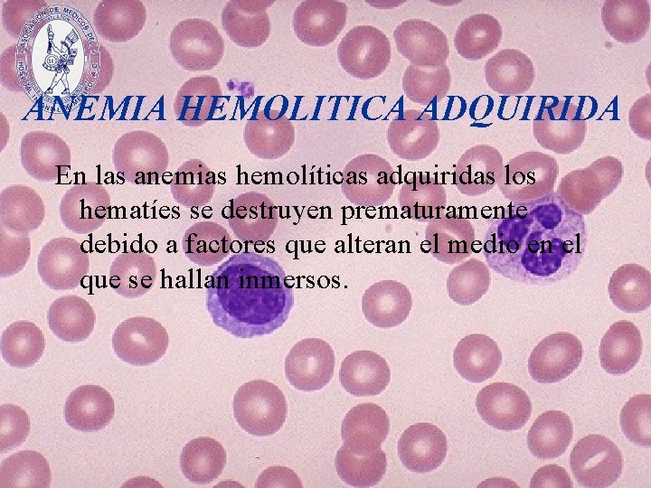 ANEMIA HEMOLITICA ADQUIRIDA En las anemias hemolíticas adquiridas los hematíes se destruyen prematuramente debido