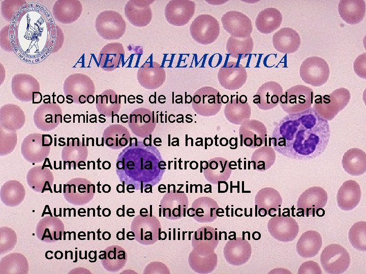 ANEMIA HEMOLITICA Datos comunes de laboratorio a todas las anemias hemolíticas: · Disminución de