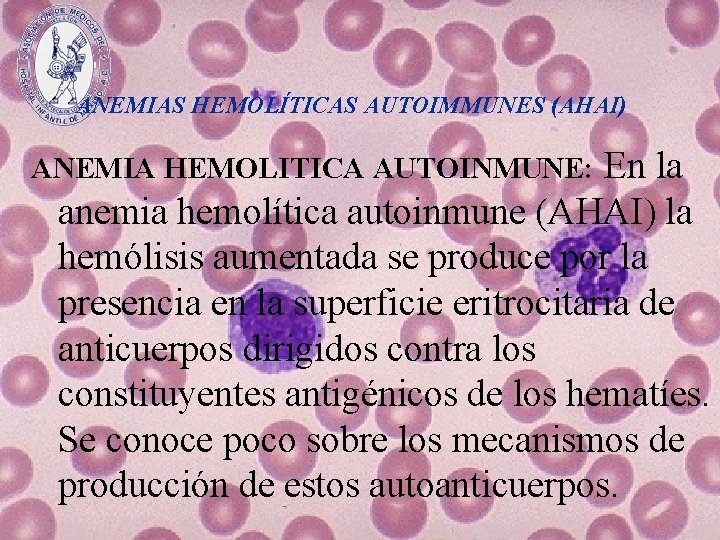 ANEMIAS HEMOLÍTICAS AUTOIMMUNES (AHAI) En la anemia hemolítica autoinmune (AHAI) la hemólisis aumentada se
