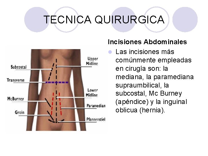 TECNICA QUIRURGICA Incisiones Abdominales l Las incisiones más comúnmente empleadas en cirugía son: la