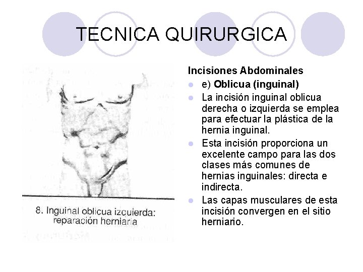 TECNICA QUIRURGICA Incisiones Abdominales l e) Oblicua (inguinal) l La incisión inguinal oblicua derecha
