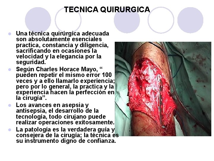 TECNICA QUIRURGICA Una técnica quirúrgica adecuada son absolutamente esenciales practica, constancia y diligencia, sacrificando