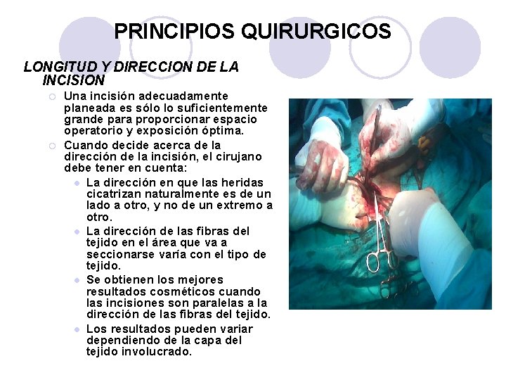 PRINCIPIOS QUIRURGICOS LONGITUD Y DIRECCION DE LA INCISION ¡ ¡ Una incisión adecuadamente planeada