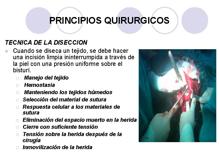 PRINCIPIOS QUIRURGICOS TECNICA DE LA DISECCION l Cuando se diseca un tejido, se debe