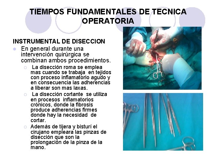 TIEMPOS FUNDAMENTALES DE TECNICA OPERATORIA INSTRUMENTAL DE DISECCION l En general durante una intervención