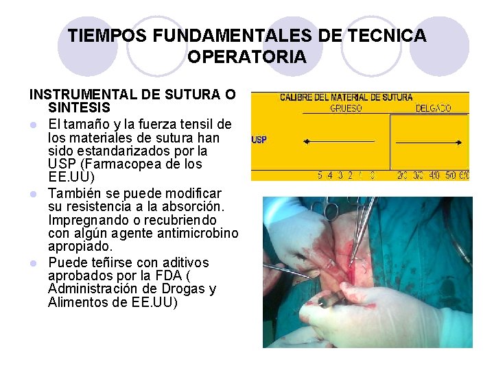 TIEMPOS FUNDAMENTALES DE TECNICA OPERATORIA INSTRUMENTAL DE SUTURA O SINTESIS l El tamaño y