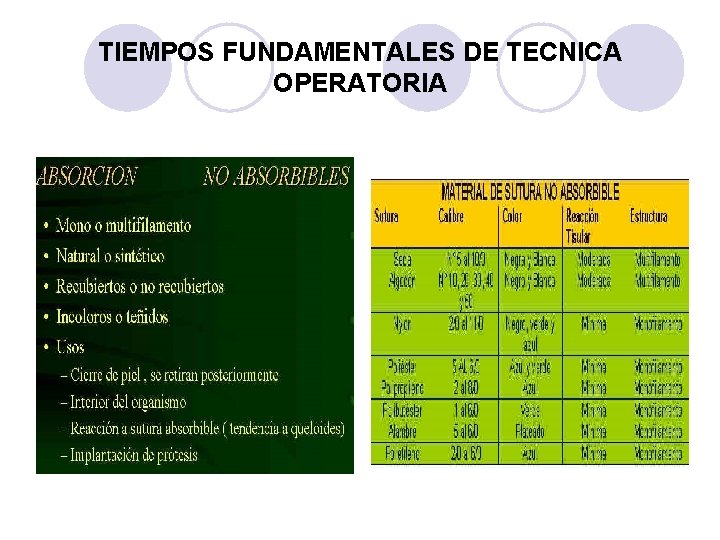 TIEMPOS FUNDAMENTALES DE TECNICA OPERATORIA 