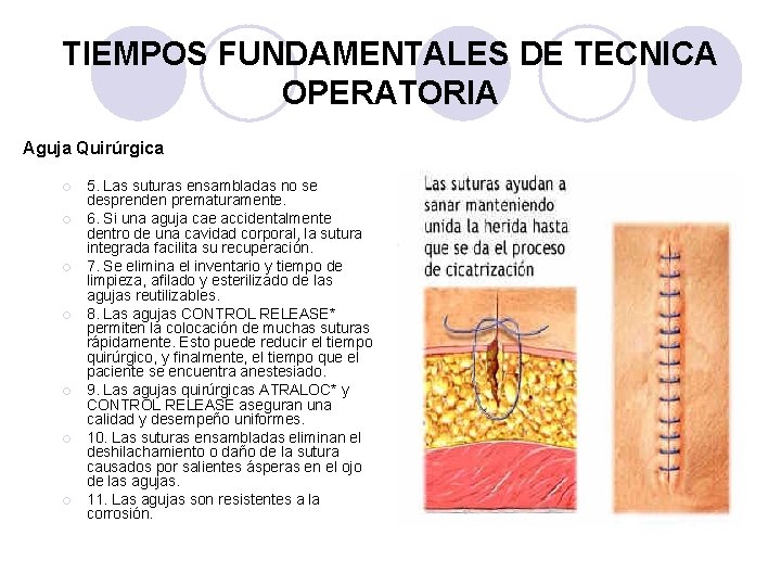 TIEMPOS FUNDAMENTALES DE TECNICA OPERATORIA Aguja Quirúrgica ¡ ¡ ¡ ¡ 5. Las suturas