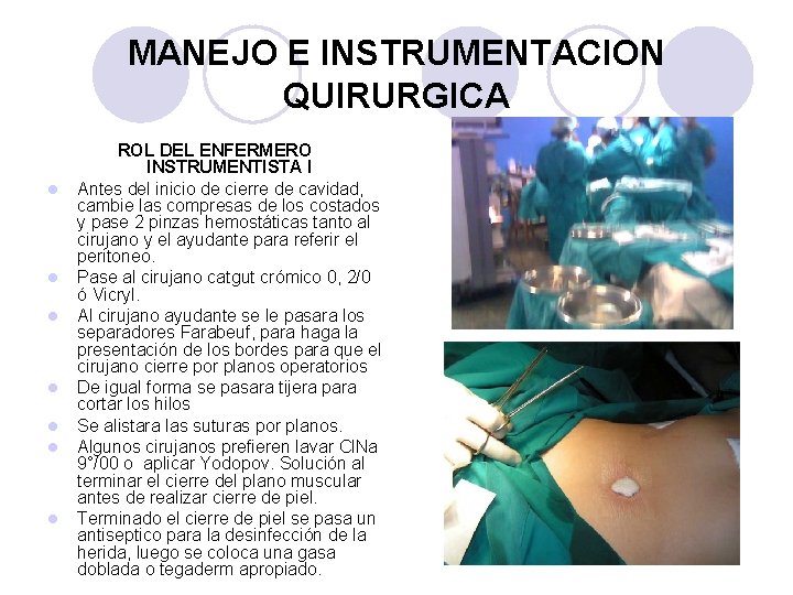 MANEJO E INSTRUMENTACION QUIRURGICA l l l l ROL DEL ENFERMERO INSTRUMENTISTA I Antes