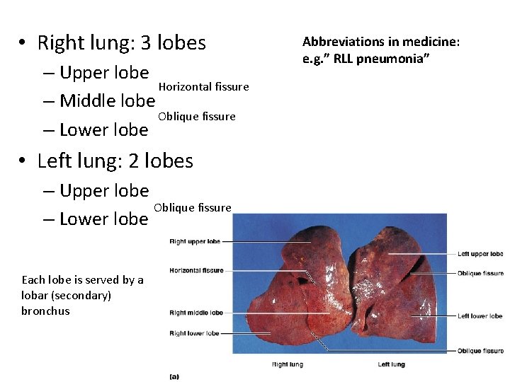  • Right lung: 3 lobes – Upper lobe Horizontal fissure – Middle lobe