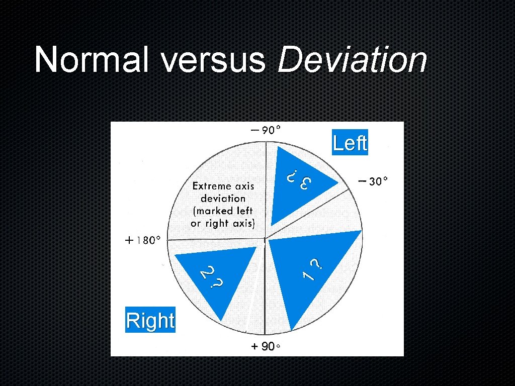 Normal versus Deviation Left 1? 3 ? 2? Right + 90∘ 