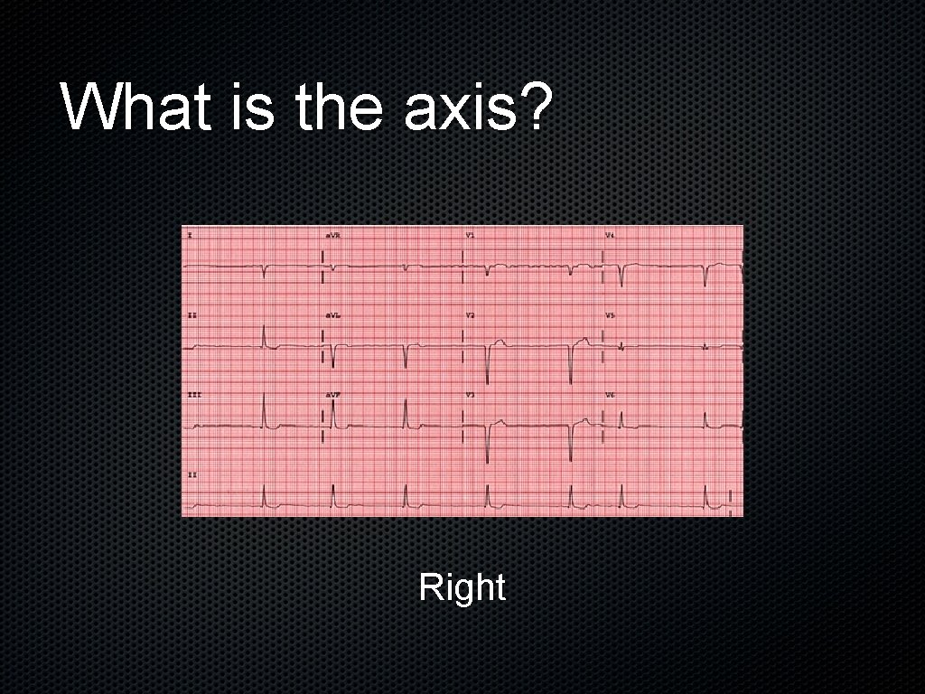 What is the axis? Right 