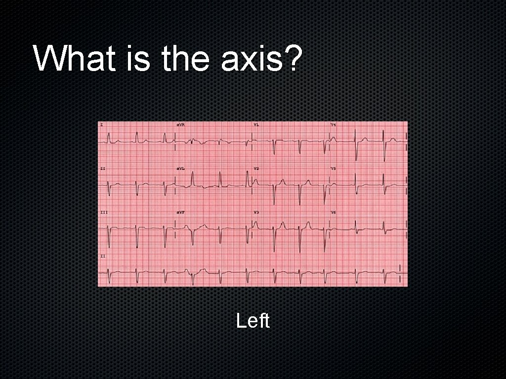 What is the axis? Left 