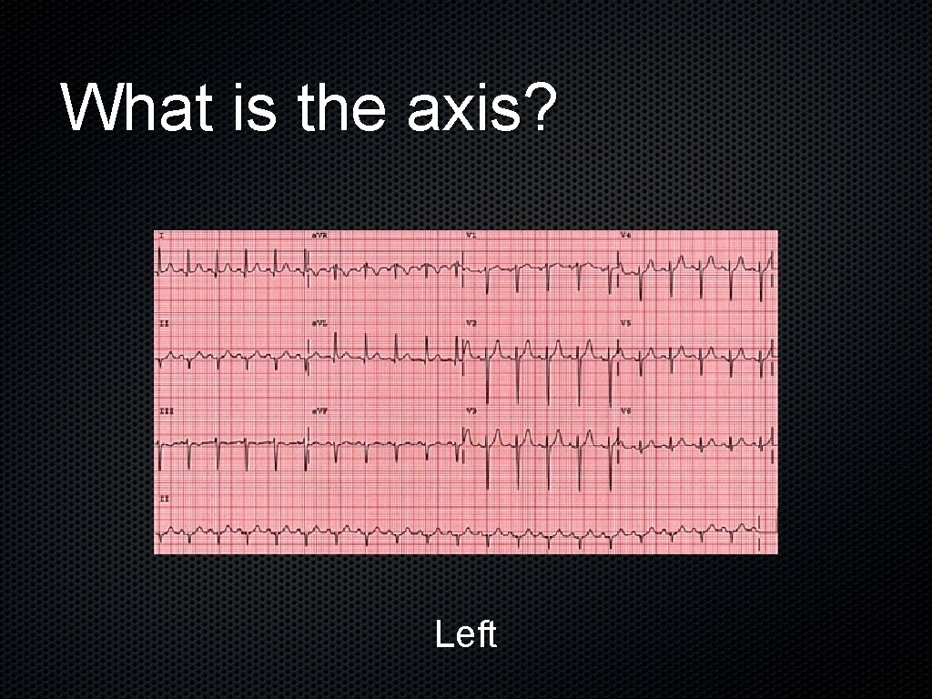 What is the axis? Left 