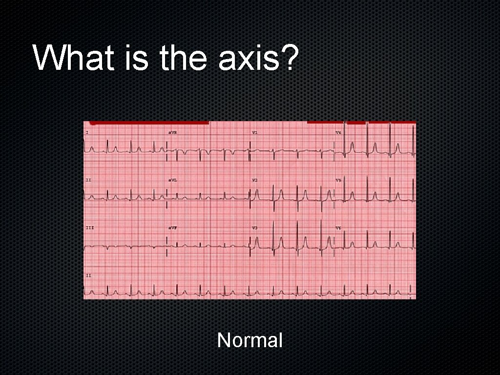 What is the axis? Normal 