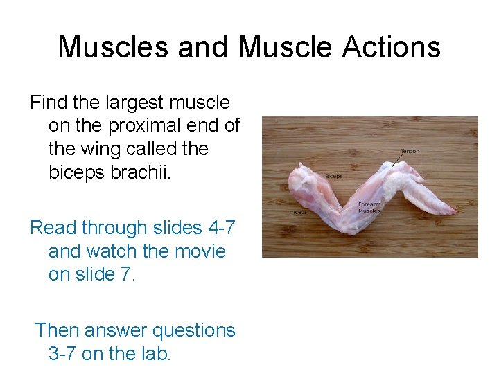 Muscles and Muscle Actions Find the largest muscle on the proximal end of the Muscles and Muscle Actions Find the largest muscle on the proximal end of the