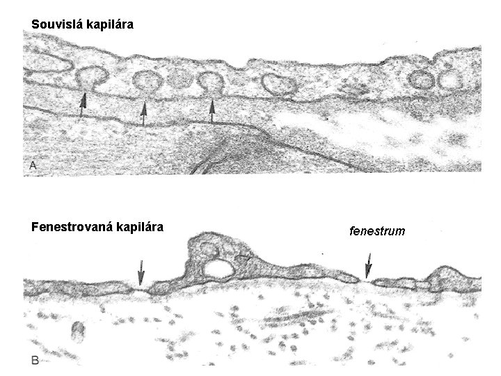 Souvislá kapilára Fenestrovaná kapilára fenestrum Souvislá kapilára Fenestrovaná kapilára fenestrum