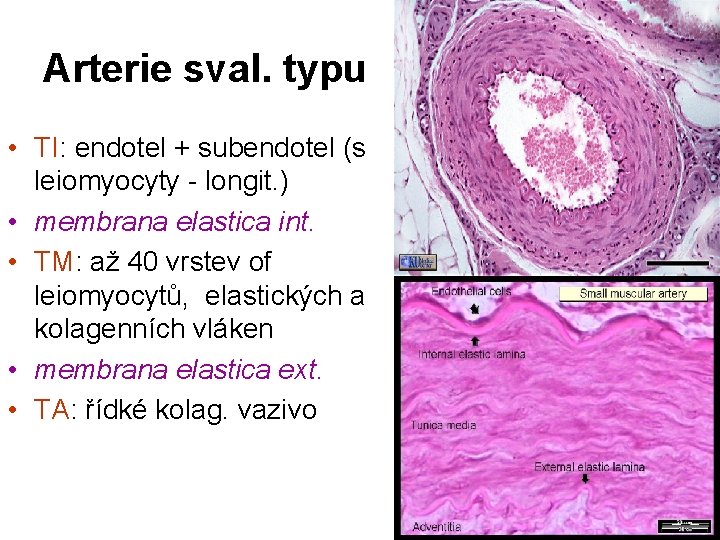 Arterie sval. typu • TI: endotel + subendotel (s leiomyocyty - longit. ) • Arterie sval. typu • TI: endotel + subendotel (s leiomyocyty - longit. ) •