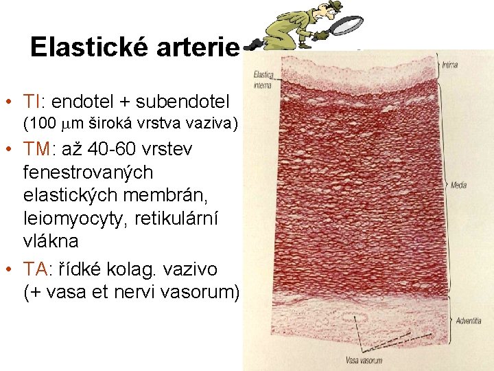 Elastické arterie • TI: endotel + subendotel (100 m široká vrstva vaziva) • TM: Elastické arterie • TI: endotel + subendotel (100 m široká vrstva vaziva) • TM: