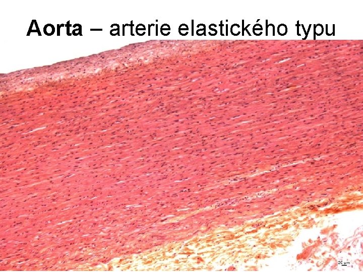 Aorta – arterie elastického typu Aorta – arterie elastického typu