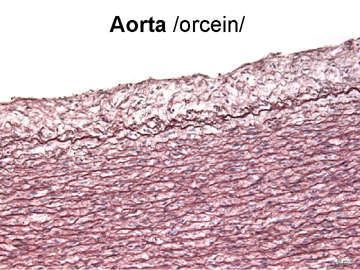 Aorta /orcein/ Aorta /orcein/