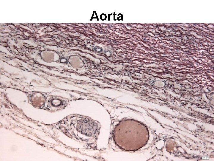 Aorta Aorta