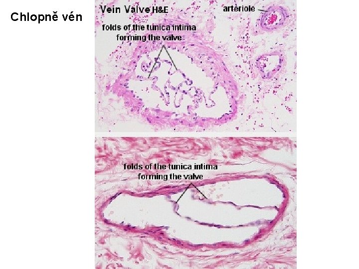 Chlopně vén Chlopně vén