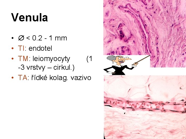 Venula • < 0. 2 - 1 mm • TI: endotel • TM: leiomyocyty Venula • < 0. 2 - 1 mm • TI: endotel • TM: leiomyocyty