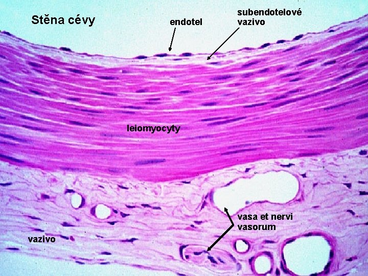 Stěna cévy endotel subendotelové vazivo leiomyocyty vasa et nervi vasorum vazivo Stěna cévy endotel subendotelové vazivo leiomyocyty vasa et nervi vasorum vazivo