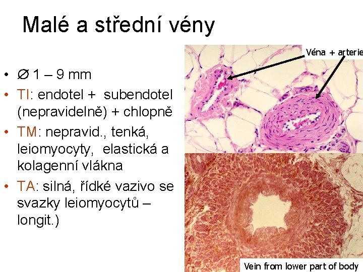 Malé a střední vény Véna + arterie • 1 – 9 mm • TI: Malé a střední vény Véna + arterie • 1 – 9 mm • TI: