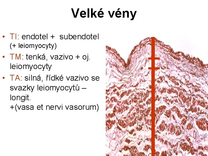 Velké vény • TI: endotel + subendotel (+ leiomyocyty) • TM: tenká, vazivo + Velké vény • TI: endotel + subendotel (+ leiomyocyty) • TM: tenká, vazivo +