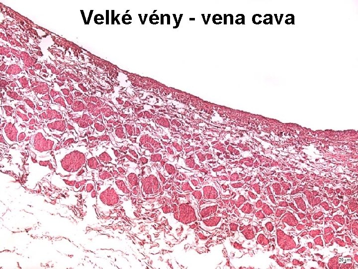 Velké vény - vena cava Velké vény - vena cava