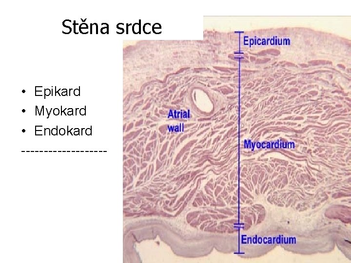 Stěna srdce • Epikard • Myokard • Endokard ---------- Stěna srdce • Epikard • Myokard • Endokard ----------