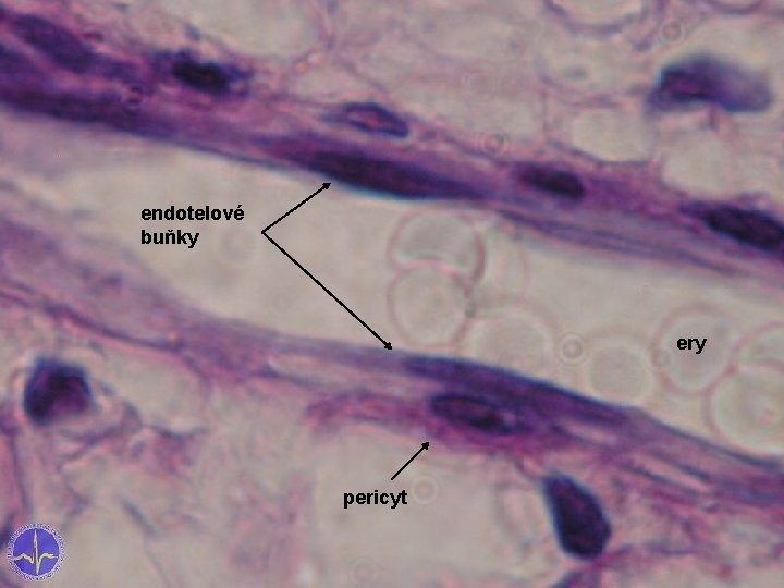 endotelové buňky ery pericyt endotelové buňky ery pericyt