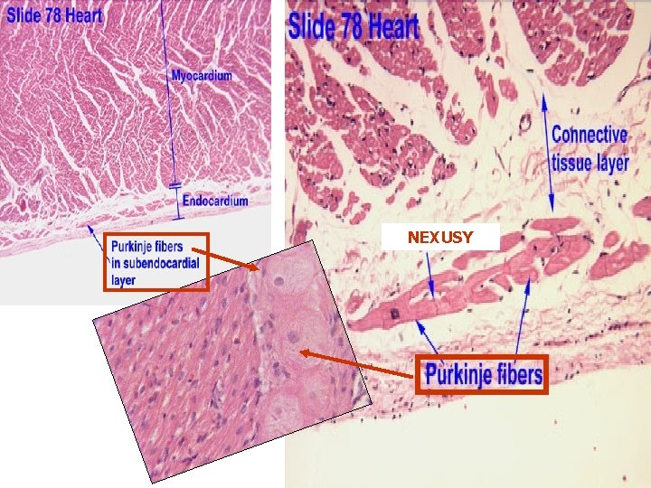 NEXUSY NEXUSY