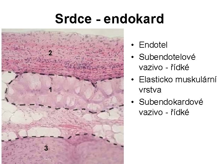 Srdce - endokard • Endotel • Subendotelové vazivo - řídké • Elasticko muskulární vrstva Srdce - endokard • Endotel • Subendotelové vazivo - řídké • Elasticko muskulární vrstva