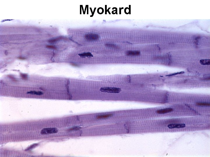 Myokard Myokard