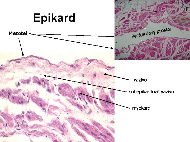 Epikard Mezotel r osto r p ý v rdo Perika vazivo subepikardové vazivo myokard Epikard Mezotel r osto r p ý v rdo Perika vazivo subepikardové vazivo myokard