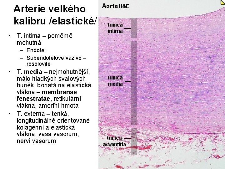 Arterie velkého kalibru /elastické/ • T. intima – poměrně mohutná – Endotel – Subendotelové Arterie velkého kalibru /elastické/ • T. intima – poměrně mohutná – Endotel – Subendotelové