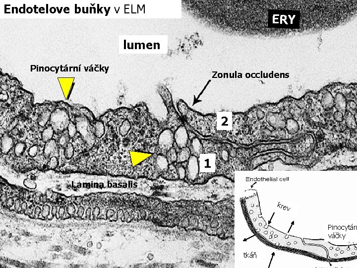 Endotelove buňky v ELM ERY lumen Pinocytární váčky Zonula occludens 2 1 Lamina basalis Endotelove buňky v ELM ERY lumen Pinocytární váčky Zonula occludens 2 1 Lamina basalis