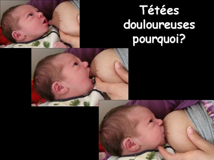 Tétées douloureuses pourquoi? 