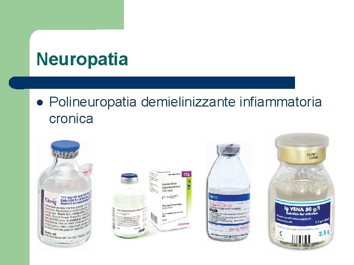 Neuropatia Polineuropatia demielinizzante infiammatoria cronica 