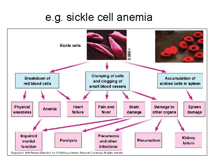 e. g. sickle cell anemia Normal RBCs 