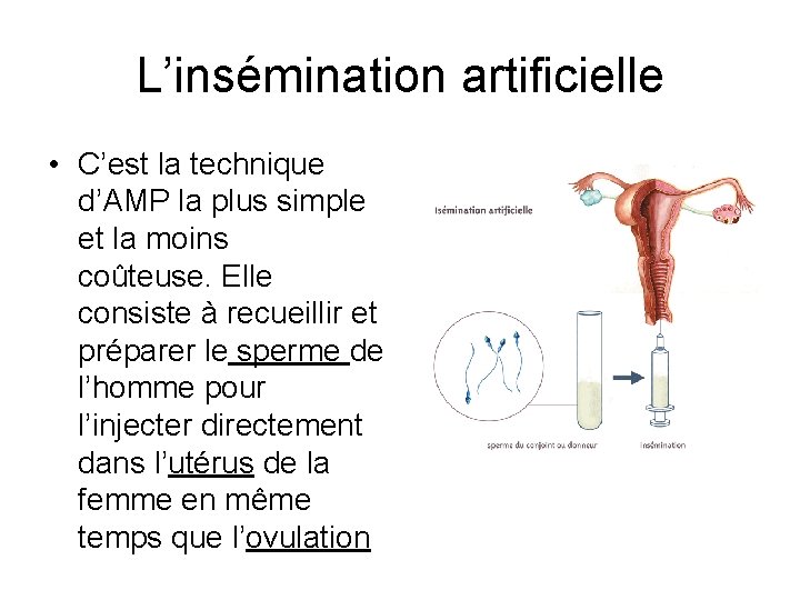 L’insémination artificielle • C’est la technique d’AMP la plus simple et la moins coûteuse.