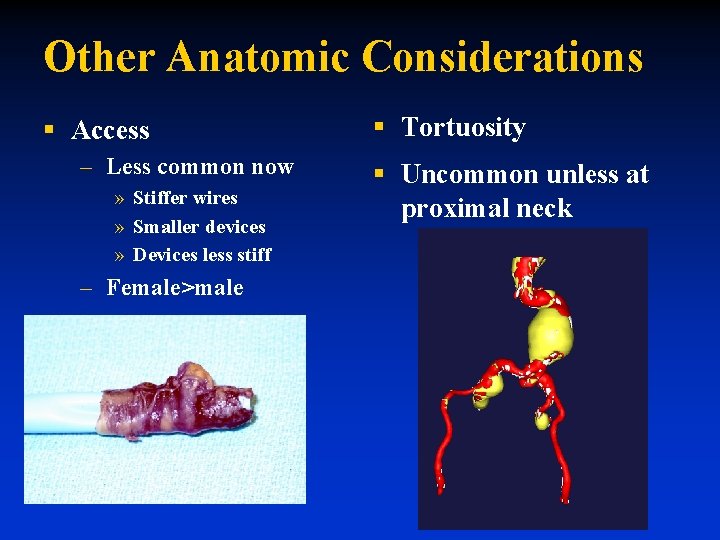 Other Anatomic Considerations § Access – Less common now » Stiffer wires » Smaller