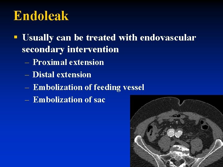 Endoleak § Usually can be treated with endovascular secondary intervention – – Proximal extension