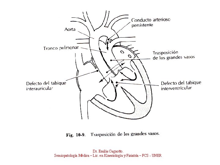 Dr. Emilia Cagnotto. Semiopatología Médica – Lic. en Kinesiología y Fisiatría – FCS -