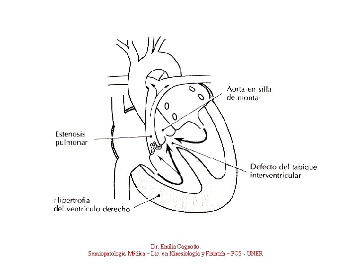 Dr. Emilia Cagnotto. Semiopatología Médica – Lic. en Kinesiología y Fisiatría – FCS -