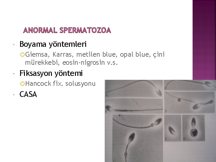 ANORMAL SPERMATOZOA Boyama yöntemleri Giemsa, Karras, metilen blue, opal blue, çini mürekkebi, eosin-nigrosin v.