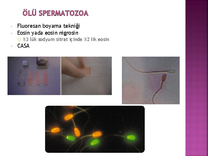 ÖLÜ SPERMATOZOA Fluoresan boyama tekniği Eosin yada eosin nigrosin %3 lük sodyum sitrat içinde